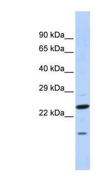 Western Blot INSIG-2 Antibody