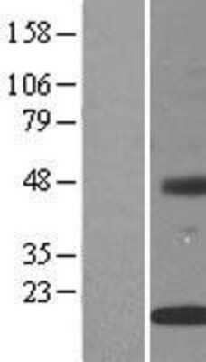 Western Blot INSIG-2 Overexpression Lysate