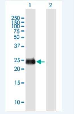 Western Blot: INSIGF Antibody [H00723961-B01P-50ug] -  Analysis of INS-IGF2 expression in transfected 293T cell line by INS-IGF2 MaxPab polyclonal antibody.  Lane 1: INS-IGF2 transfected lysate(22 KDa). Lane 2: Non-transfected lysate.