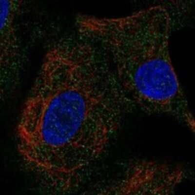 Immunocytochemistry/Immunofluorescence: INSL4 Antibody [NBP3-17385] - Staining of human cell line A549 shows localization to vesicles.