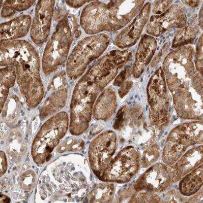 Immunohistochemistry-Paraffin: INSRR/IR-related receptor Antibody [NBP1-87704] - Staining of human kidney shows strong cytoplasmic positivity in cells in tubules.