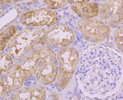 Immunohistochemistry-Paraffin: INSRR/IR-related receptor Antibody (JM22-38) [NBP2-66906] - Analysis of paraffin-embedded human kidney tissue using anti-Insulin Receptor R antibody. Counter stained with hematoxylin.