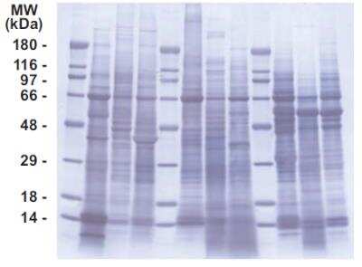 SDS-Page: INSTA-Blot Multi-species Stomach, Small Intestine and Pancreas [NBP2-30118] - Approximately 20 ug per lane of tissue lysates and resolved by SDS-PAGE, transfered onto PVDF membrane and stained with amido black. Lanes: 1. Molecular weight marker; 2. human stomach; 3. mouse stomach; 4. rat stomach; 5. Molecular weight marker; 6. human small intestine; 7. mouse small intestine; 8. rat small intestine; 9. Molecular weight marker; 10. human pancreas; 11. mouse pancreas; 12. rat pancreas.