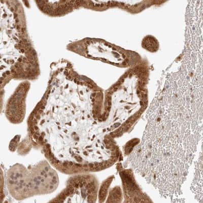 Immunohistochemistry-Paraffin: INTS11 Antibody [NBP1-85474] - Staining of human placenta shows moderate to strong cytoplasmic positivity in trophoblastic cells.