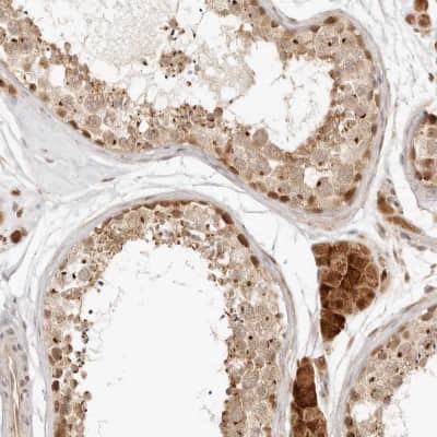 Immunohistochemistry-Paraffin: INTS11 Antibody [NBP1-85474] - Staining of human testis shows strong cytoplasmic positivity in Leydig cells, as well as moderate cytoplasmic and nuclear positivity in cells in seminiferous ducts.