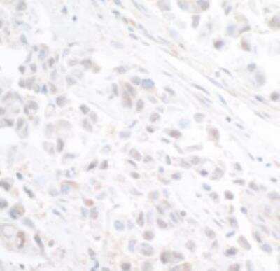 Immunohistochemistry-Paraffin INTS11 Antibody - BSA Free