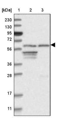 Western Blot INTS11 Antibody - BSA Free