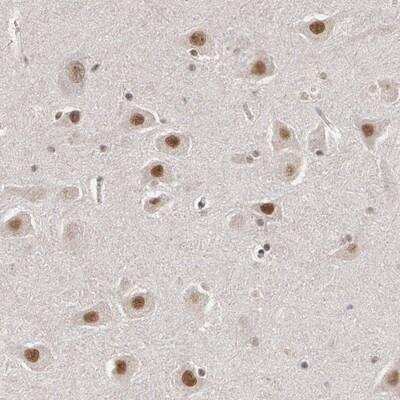 Immunohistochemistry: INTS6 Antibody [NBP1-88029] - Staining of human hippocampus shows strong nuclear positivity in neuronal cells.