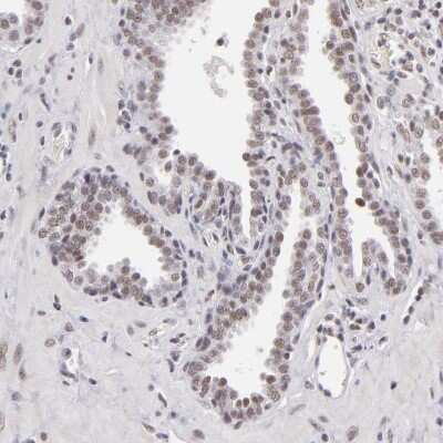 Immunohistochemistry-Paraffin: INTS6 Antibody [NBP1-85302] - Staining of human prostate shows weak nuclear positivity in glandular cells.