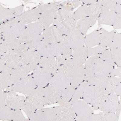 Immunohistochemistry-Paraffin: INTS6 Antibody [NBP1-85302] - Staining of human skeletal muscle shows low positivity in myocytes as expected.