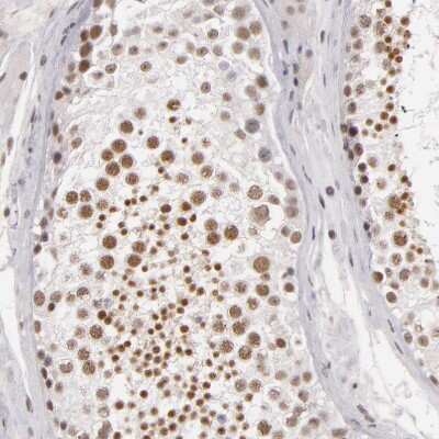 Immunohistochemistry-Paraffin: INTS6 Antibody [NBP1-85302] - Staining of human testis shows moderate nuclear positivity in cells in seminiferous ducts.