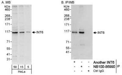Western Blot INTS6 Antibody