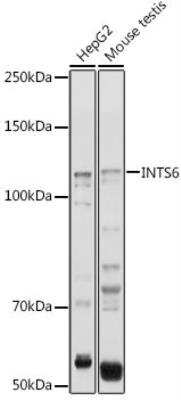 Western Blot: INTS6 Antibody [NBP3-04624] - Analysis of extracts of various cell lines, using INTS6 antibody at 1:1000 dilution.Secondary antibody: HRP Goat Anti-Rabbit IgG (H+L) at 1:10000 dilution.Lysates/proteins: 25ug per lane. Blocking buffer: 3% nonfat dry milk in TBST.Detection: ECL Basic Kit. Exposure time: 1s.