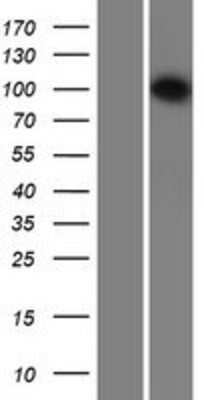Western Blot: INTS6 Overexpression Lysate (Adult Normal) [NBP2-07487] Left-Empty vector transfected control cell lysate (HEK293 cell lysate); Right -Over-expression Lysate for INTS6.