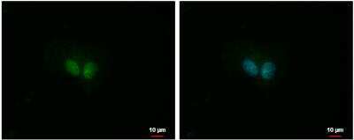 Immunocytochemistry/Immunofluorescence: IP3KC Antibody [NBP2-16982] - RD cells were fixed in 4% paraformaldehyde at RT for 15 min. Green: IP3KC protein stained by IP3KC antibody [N3C2], Internal diluted at 1:500. Blue: Hoechst 33342 staining. Scale bar = 10 um.