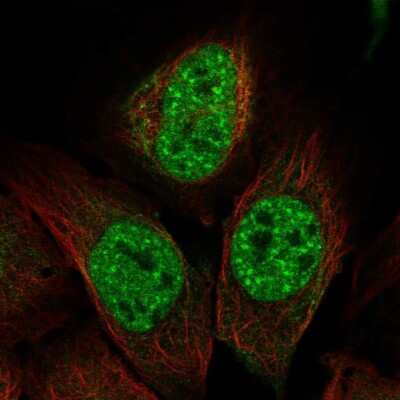 Immunocytochemistry/ Immunofluorescence IP3KC Antibody - BSA Free