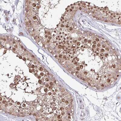 Immunohistochemistry IP3KC Antibody - BSA Free