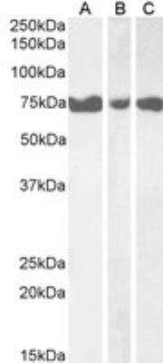 Western Blot: IP3KC Antibody [NBP1-36962] - taining of Human Pancreas (A), Heart (B) and Skeletal Muscle (C) lysates (35ug protein in RIPA buffer). Primary incubation was 1 hour. Detected by chemiluminescence.