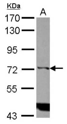 Western Blot: IP3KC Antibody [NBP2-16982] - Sample (30 ug of whole cell lysate) A: Raji 7. 5% SDS PAGE gel, diluted at 1:1000.