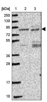 Western Blot IP3KC Antibody - BSA Free
