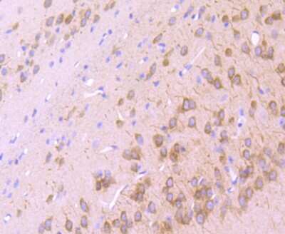 Immunohistochemistry-Paraffin: IP3R1 Antibody (JA11-35) [NBP2-66910] - Analysis of paraffin-embedded mouse hippocampus tissue using anti-IP3 Receptor antibody. Counter stained with hematoxylin.
