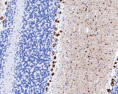 Immunohistochemistry-Paraffin: IP3R1 Antibody (JA11-35) [NBP2-66910] - Immunohistochemical analysis of paraffin-embedded rat cerebellum tissue using anti-IP3R1 antibody. The section was pre-treated using heat mediated antigen retrieval with Tris-EDTA buffer (pH 8.0-8.4) for 20 minutes. The tissues were blocked in 5% BSA for 30 minutes at room temperature, washed with ddH2O and PBS, and then probed with the primary antibody (1/200) for 30 minutes at room temperature. The detection was performed using an HRP conjugated compact polymer system. DAB was used as the chromogen. Tissues were counterstained with hematoxylin and mounted with DPX.