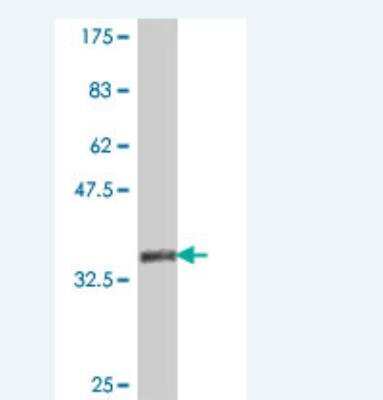 Western Blot: IP3R1 Antibody [H00003708-A01] - Detection against Immunogen (37.99 KDa) .