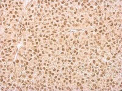 Immunohistochemistry-Paraffin: IP6K1 Antibody (10611) [NBP2-43667] - Analysis of HeLa xenograft. IP6K1 antibody dilution: 1:200.
