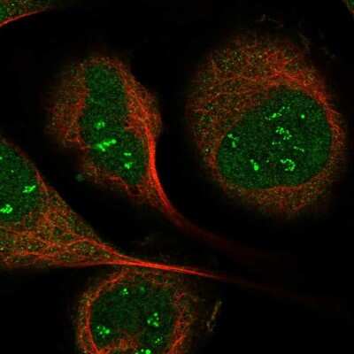 Immunocytochemistry/Immunofluorescence: IP6K1 Antibody [NBP1-92026] - Staining of human cell line U-2 OS shows localization to nucleoli fibrillar center & cytosol. Antibody staining is shown in green.