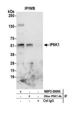 Immunoprecipitation: IP6K1 Antibody [NBP2-59105] - Detection of human IP6K1 by western blot of immunoprecipitates. Samples: Whole cell lysate (0.5 or 1.0 mg per IP reaction; 20% of IP loaded) from Jurkat cells prepared using NETN lysis buffer. Antibodies: Affinity purified rabbit anti-IP6K1 antibody NBP2-59105 used for IP at 8 ul per reaction. IP6K1 was also immunoprecipitated by another rabbit anti-IP6K1 antibody. For blotting immunoprecipitated IP6K1, NBP2-59105 was used at 1:400. Detection: Chemiluminescence with an exposure time of 30 seconds.