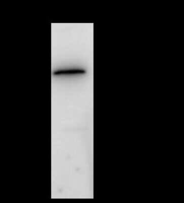 Immunoprecipitation: IP6K1 Antibody [NBP2-99495] - IP6K1 was immunoprecipitated using: Lane A: 0.5 mg A431 Whole Cell Lysate 4 ul anti-IP6K1 rabbit polyclonal antibody and 60 ug of Immunomagnetic beads Protein A/G.  Primary antibody: Anti-IP6K1 rabbit polyclonal antibody, at 1:100 dilution. Secondary antibody: Clean-Blot IP Detection Reagent (HRP) at 1:1000dilution. Developed using the ECL technique. Performed under reducing conditions. Predicted band size: 50 kDa. Observed band size: 50 kDa