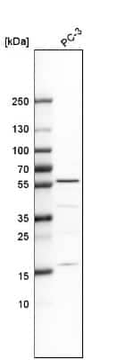 Western Blot IP6K1 Antibody - BSA Free