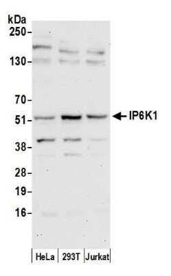 Western Blot: IP6K1 Antibody [NBP2-59105] - Detection of human IP6K1 by western blot. Samples: Whole cell lysate (50 ug) from HeLa, 293T, and Jurkat cells prepared using NETN lysis buffer. Antibody: Affinity purified rabbit anti-IP6K1 antibody NBP2-59105 used for WB at 1:1000. Detection: Chemiluminescence with an exposure time of 30 seconds.