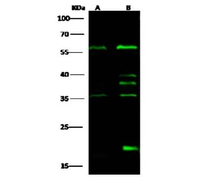 Western Blot: IP6K1 Antibody [NBP3-00228] - Anti-IP6K1 rabbit polyclonal antibody at 1:500 dilution. Lane A: MOLT4 Whole Cell Lysate. Lane B: Hela Whole Cell Lysate. Lysates/proteins at 30 ug per lane. Secondary Goat Anti-Rabbit IgG H&L (Dylight 800) at 1/10000 dilution. Developed using the Odyssey technique. Performed under reducing conditions. Predicted band size: 50 kDa. Observed band size: 56 kDa (We are unsure as to the identity of these extra bands).