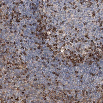 Immunohistochemistry-Paraffin IPCEF1 Antibody