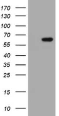 Western Blot: IPCEF1 Antibody (OTI3G2) - Azide and BSA Free [NBP2-71781] - Analysis of HEK293T cells were transfected with the pCMV6-ENTRY control (Left lane) or pCMV6-ENTRY IPCEF1.