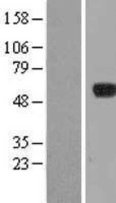 Western Blot: IPCEF1 Overexpression Lysate (Adult Normal) [NBL1-14431] Left-Empty vector transfected control cell lysate (HEK293 cell lysate); Right -Over-expression Lysate for IPCEF1.