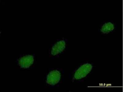 Immunocytochemistry/Immunofluorescence: IPMK Antibody [H00253430-B01P] - Analysis of purified antibody to IPMK on HeLa cell. (antibody concentration 10 ug/ml)
