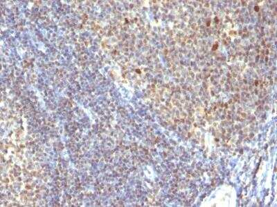 Immunohistochemistry-Paraffin: IPO-38 Antibody (SPM260) - IHC-Prediluted [NBP2-48276] - Human Tonsil stained with IPO38 Monoclonal Antibody (SPM260).
