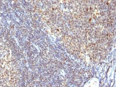 Immunohistochemistry-Paraffin: IPO-38 Antibody (SPM260) [NBP2-45203] - Human Tonsil stained with IPO38 Monoclonal Antibody (SPM260).