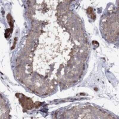 Immunohistochemistry-Paraffin: IPP Antibody [NBP3-17387] - Staining of human testis shows cytoplasmic positivity in Leydig cells and cells in seminiferous ducts.