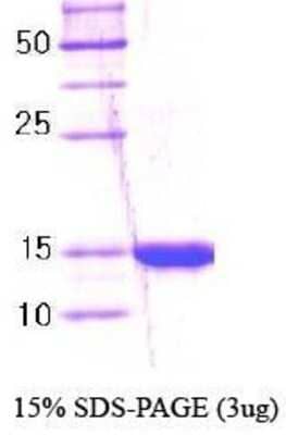 SDS-Page: IPP Protein [NBC1-18418] - IPP-POZ domain, 17.3 kDa (157 aa), confirmed by MALDI-TOF with a purity of 95% by SDS - PAGE