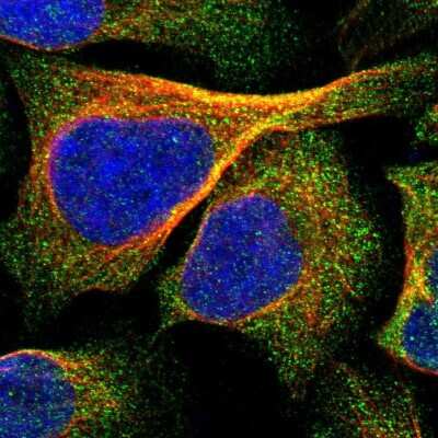 Immunocytochemistry/ Immunofluorescence IPPK Antibody - BSA Free