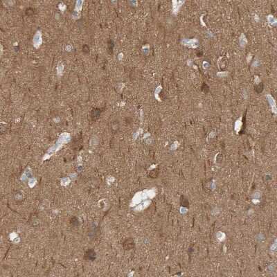 Immunohistochemistry-Paraffin IPPK Antibody - BSA Free