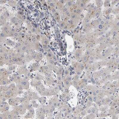 Immunohistochemistry-Paraffin IPPK Antibody - BSA Free