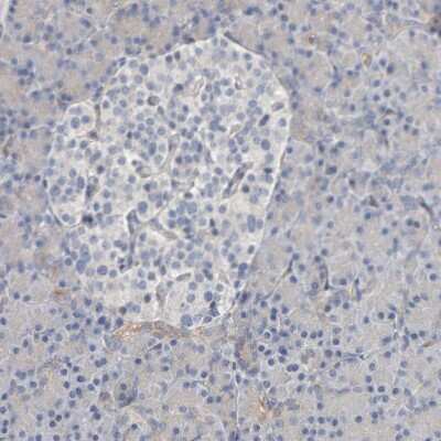 Immunohistochemistry-Paraffin IPPK Antibody - BSA Free