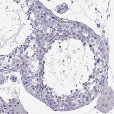 Immunohistochemistry-Paraffin IQCD Antibody - BSA Free