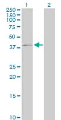 Western Blot: IQCD Antibody [H00115811-B01P] - Analysis of IQCD expression in transfected 293T cell line by IQCD polyclonal antibody.  Lane 1: IQCD transfected lysate(38.17 KDa). Lane 2: Non-transfected lysate.