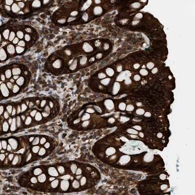 Immunohistochemistry-Paraffin IQCE Antibody - BSA Free