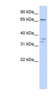 Western Blot: IQCE Antibody [NBP1-79590] - Human Placenta lysate, concentration 0.2-1 ug/ml.